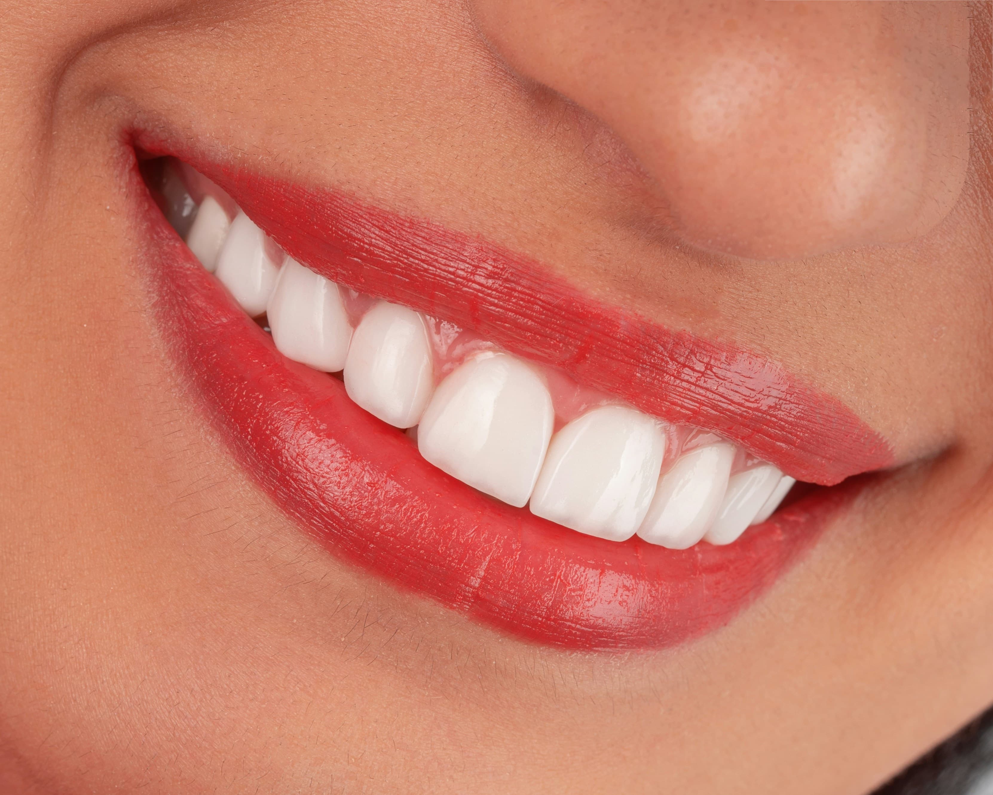 Patient smiling after treatment